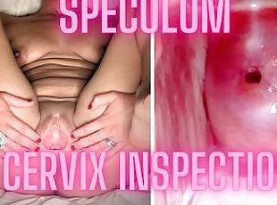 Äärimmäiset, Pillu (Pussy), Äityli, Sairaala, Gynekologinen testi, Levitys