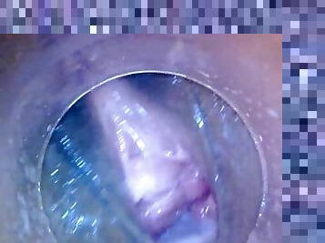 Beautiful Japanese creampie!! Endoscope!! Coffee can insertion!!