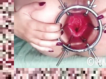 Fisting Latinas Speculum Gaped Ass